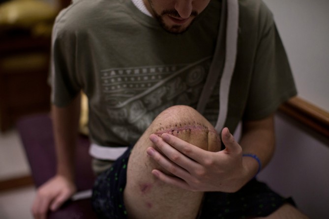 Initially, he could not stand to see his amputated legs, but he gradually grew more comfortable with them. Several days after the sutures came out, he had his first appointment with a prosthetist. (Josh Haner, The New York Times - May 21, 2013)