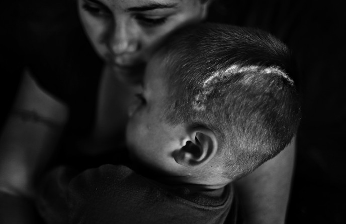 In Long Beach, amid the duplexes ad the shaggy palm trees, two different worlds were playing out. On the sidewalk in front of his house, 4 year-old Josue Hercules was playing with his sister. Down the street, a 46 year-old man with a history of gang activity and crime, according to police, got into an argument and pulled a gun. One of the bullets hit Josue in the back of the head, skirted his skull and lodged near his eye. Recovery has been uneven. Wendoly Andrade holds her son, Josue, at their home in Long