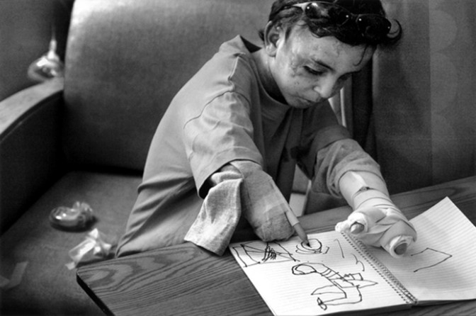 Though usually upbeat, Saleh was sensitive about his appearance. One afternoon, when he saw other children staring at him, Saleh became angry and upset. Nurses sought to soothe him by taping a felt tip pen to this arm so he could draw pictures. Saleh drew an airplane dropping bombs.