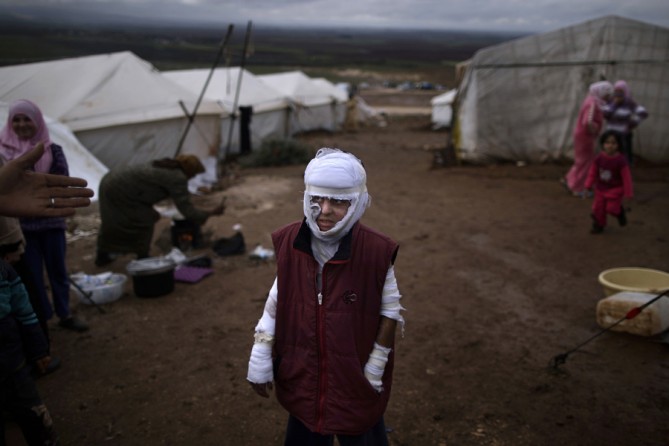 Abdullah Ahmed, 10, who suffered burns in a Syrian government airstrike and fled his home with his family, stands outside their tent at a camp for displaced Syrians in the village of Atmeh, Syria, Dec. 11, 2012. (Muhammed Muheisen, Associated Press - December 11, 2012)