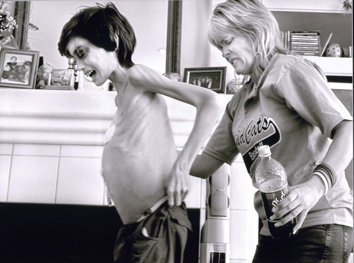 Derek has a final burst of energy after days of Cyndie keeping vigil at his bedside. She helps her anguished son walk on April 26. A cancerous tumor has distended Derek's stomach so far that his pants no longer fit. Another tumor in his brain impairs his eyesight making navigation difficult inside their rental home.
