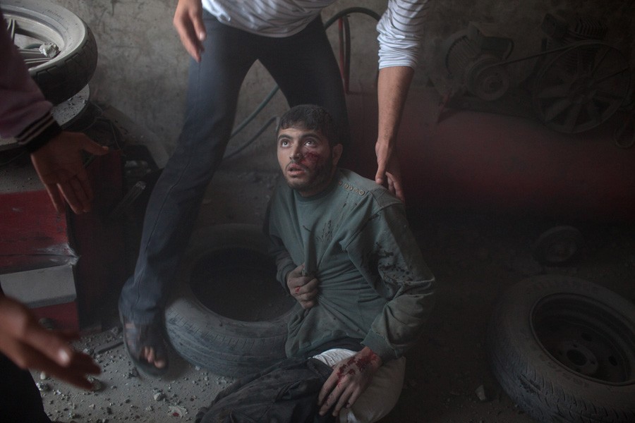 An injured man moments after three bombs exploded in Gaza City, killing one and injuring several others. (November 17, 2012)