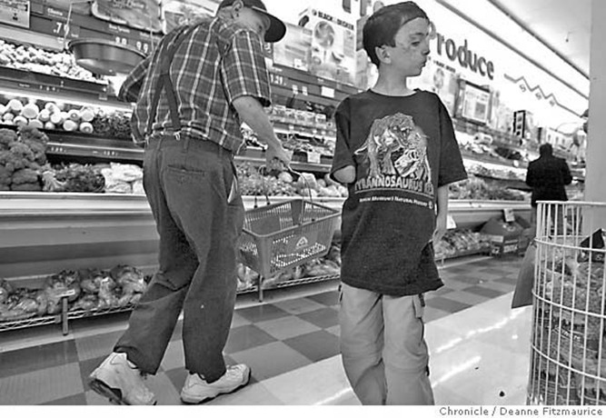 As he ventured more often outside the hospital, Saleh took to wearing sunglasses to hide his scars. On this trip to the grocery store, he forgot them and drew the stares of other customers.