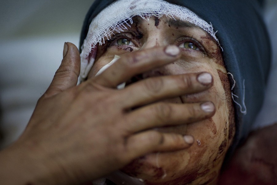 A woman named Aida cries as she recovers from severe injuries after the Syrian army shelled her house in Idlib, northern Syria, March 10, 2012. Aida's husband and two children were killed in the attack. (Rodrigo Abd, Associated Press - March 10, 2012)