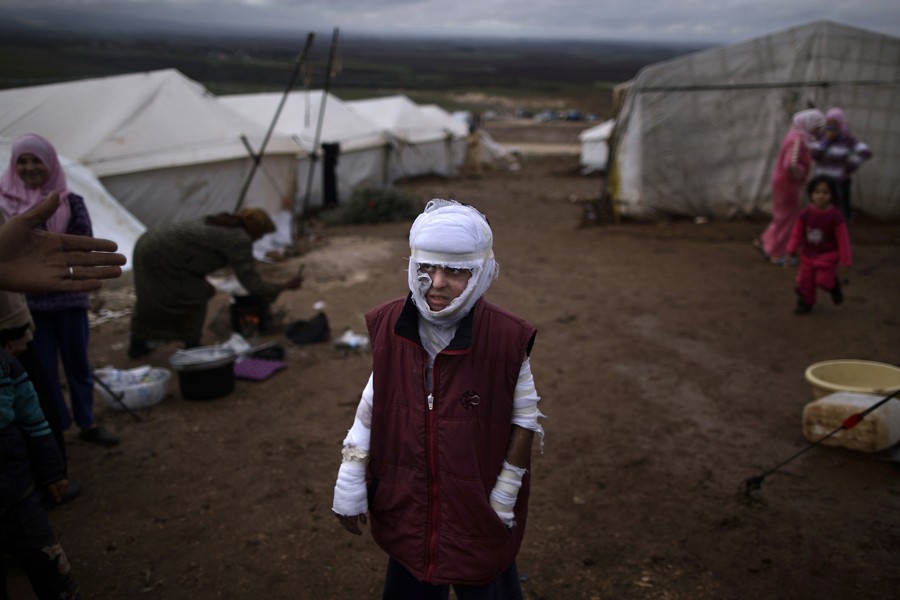 Abdullah Ahmed, 10, who suffered burns in a Syrian government airstrike and fled his home with his family, stands outside their tent at a camp for displaced Syrians in the village of Atmeh, Syria, Dec. 11, 2012. (Muhammed Muheisen, Associated Press - December 11, 2012)